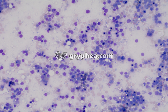 Moelle osseuse frottis x100 - gryphea.org